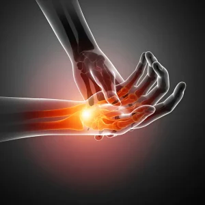 Carpal-Tunnel_Syndrome-cat-img