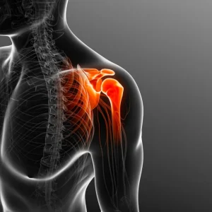 frozen_shoulder-cat-img