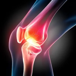 ligament_injuries-cat-img